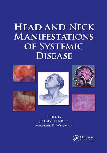 Head and Neck Manifestations of Systemic Disease