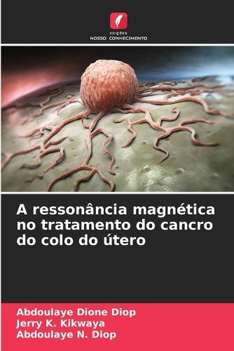 Cover image for A ressonancia magnetica no tratamento do cancro do colo do utero