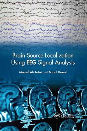 Cover image for Brain Source Localization Using EEG Signal Analysis