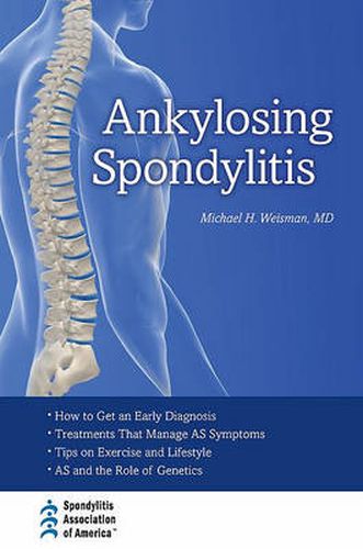 Cover image for Ankylosing Spondylitis