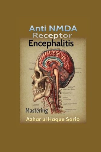 Cover image for Mastering Anti NMDA Receptor Encephalitis