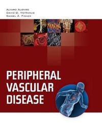 Cover image for Peripheral Vascular Disease