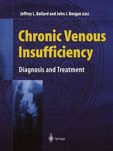 Venous Insufficiency: Diagnosis and Treatment