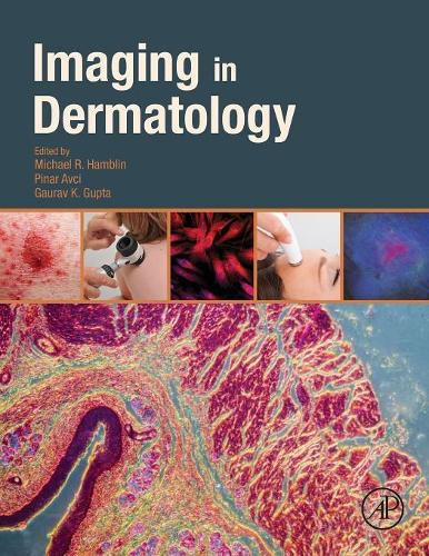 Imaging in Dermatology