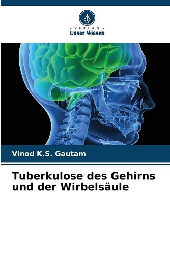 Cover image for Tuberkulose des Gehirns und der Wirbelsaeule