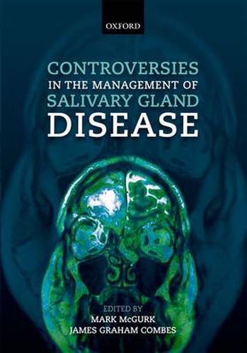 Cover image for Controversies in the Management of Salivary Gland Disease