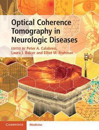 Cover image for Optical Coherence Tomography in Neurologic Diseases