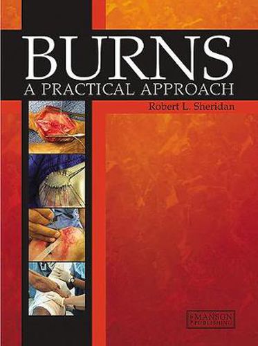 Cover image for Burns: A Practical Approach to Immediate Treatment and Long Term Care