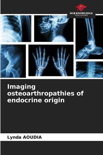 Cover image for Imaging osteoarthropathies of endocrine origin