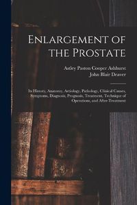 Cover image for Enlargement of the Prostate