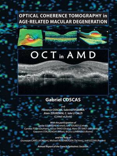 Cover image for Optical Coherence Tomography in Age-Related Macular Degeneration