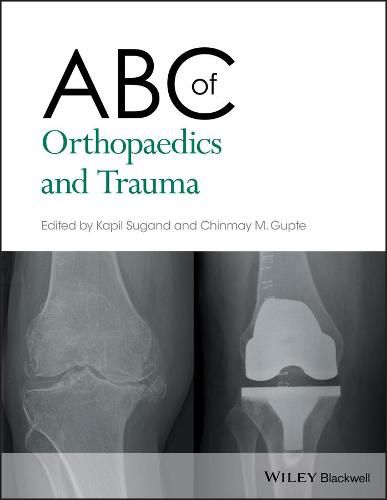 Cover image for ABC of Orthopaedics and Trauma