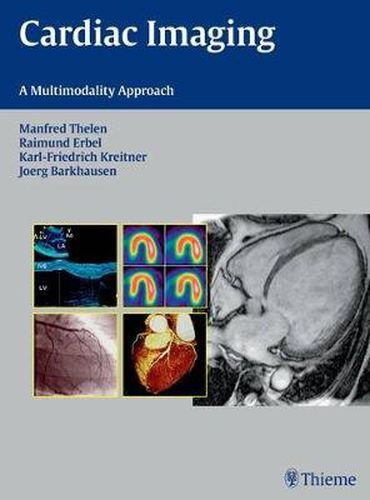 Cover image for Cardiac Imaging: A Multimodality Approach