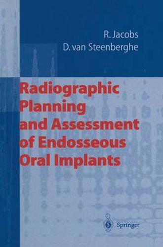 Cover image for Radiographic Planning and Assessment of Endosseous Oral Implants