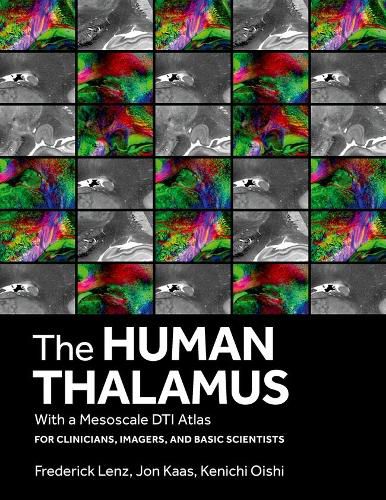 Cover image for The Human Thalamus with a Mesoscale DTI Atlas