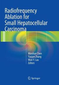 Cover image for Radiofrequency Ablation for Small Hepatocellular Carcinoma