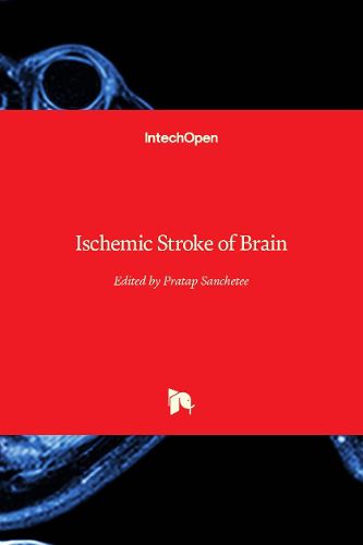 Cover image for Ischemic Stroke of Brain