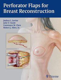 Cover image for Perforator Flaps for Breast Reconstruction