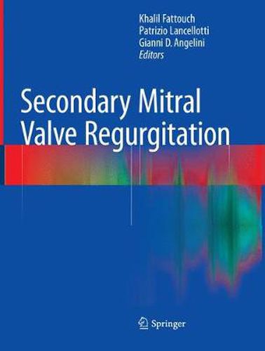 Cover image for Secondary Mitral Valve Regurgitation