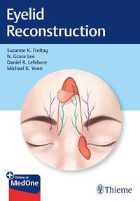 Cover image for Eyelid Reconstruction