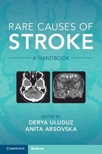 Cover image for Rare Causes of Stroke: A Handbook