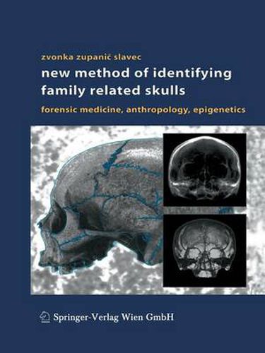 Cover image for New Method of Identifying Family Related Skulls: Forensic Medicine, Anthropology, Epigenetics