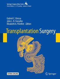 Cover image for Transplantation Surgery