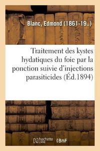 Cover image for Note Sur Le Traitement Des Kystes Hydatiques Du Foie Par La Ponction