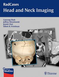 Cover image for RadCases Head and Neck Imaging