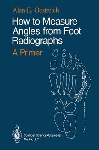 Cover image for How to Measure Angles from Foot Radiographs: A Primer