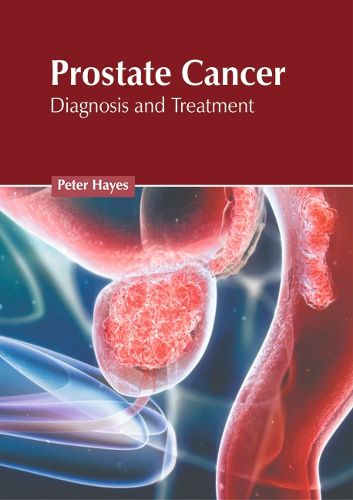 Cover image for Prostate Cancer: Diagnosis and Treatment