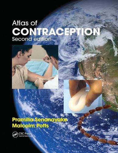 Cover image for Atlas of Contraception