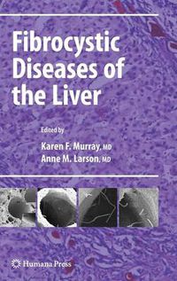 Cover image for Fibrocystic Diseases of the Liver