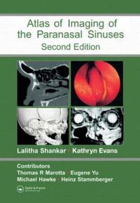 Cover image for Atlas of Imaging of the Paranasal Sinuses, Second Edition