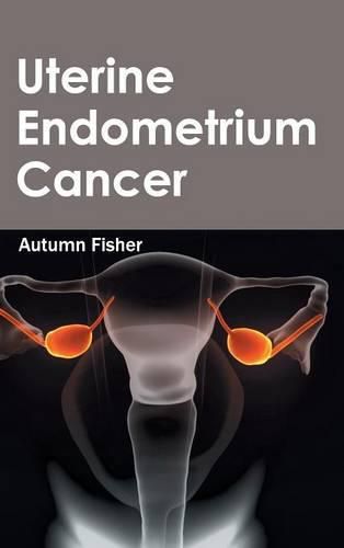 Cover image for Uterine Endometrium Cancer