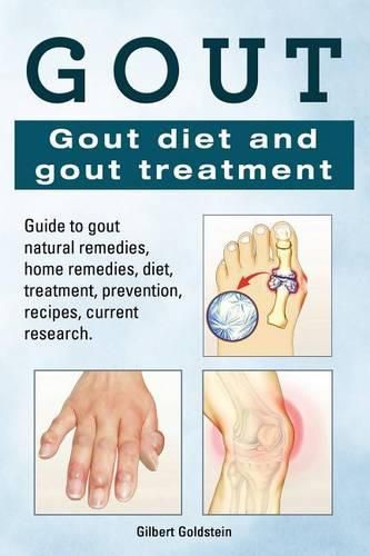 Cover image for Gout. Gout diet and gout treatment. Guide to gout natural remedies, home remedies, diet, treatment, prevention, recipes, current research.