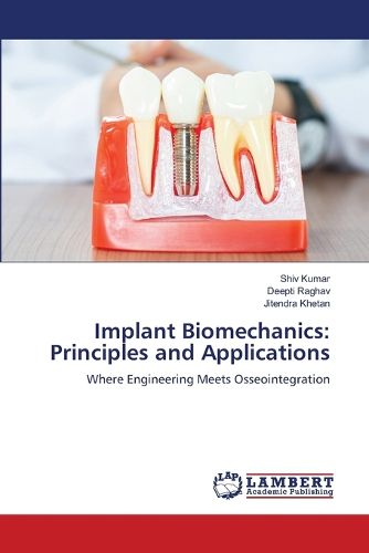 Cover image for Implant Biomechanics