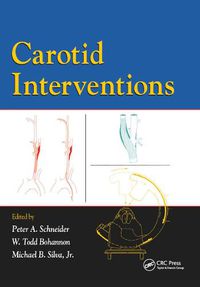 Cover image for Carotid Interventions