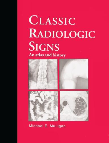 Cover image for Classic Radiologic Signs: An Atlas and History