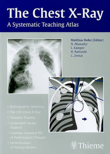 The Chest X-Ray: A Systematic Teaching Atlas