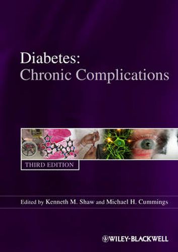 Cover image for Diabetes Chronic Complications