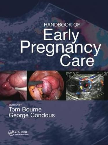 Cover image for Handbook of Early Pregnancy Care