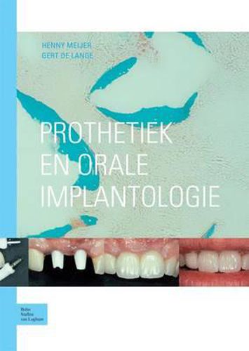 Cover image for Prothetiek En Orale Implantologie