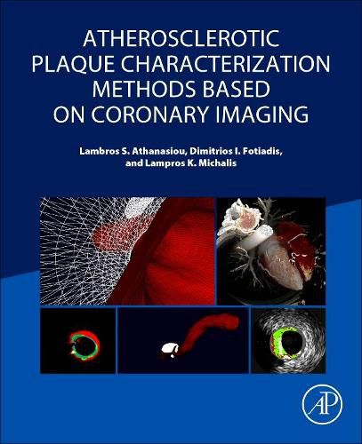 Cover image for Atherosclerotic Plaque Characterization Methods Based on Coronary Imaging