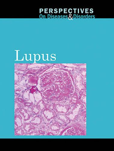 Cover image for Lupus