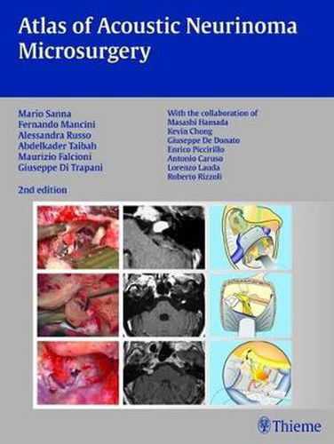 Atlas of Acoustic Neurinoma Microsurgery