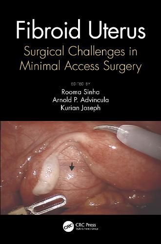 Cover image for Fibroid Uterus: Surgical Challenges in Minimal Access Surgery