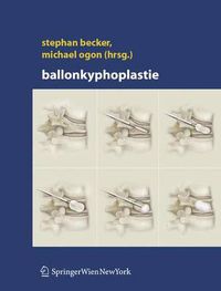 Cover image for Ballonkyphoplastie