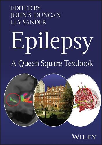 Cover image for Epilepsy