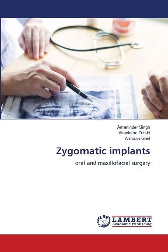 Cover image for Zygomatic implants
